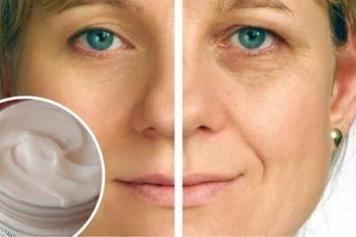 Creme Caseiro para Rugas